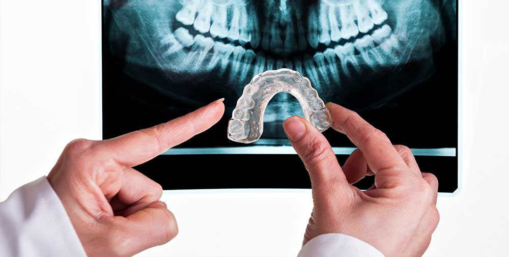 Imatge - Protector buco-dental